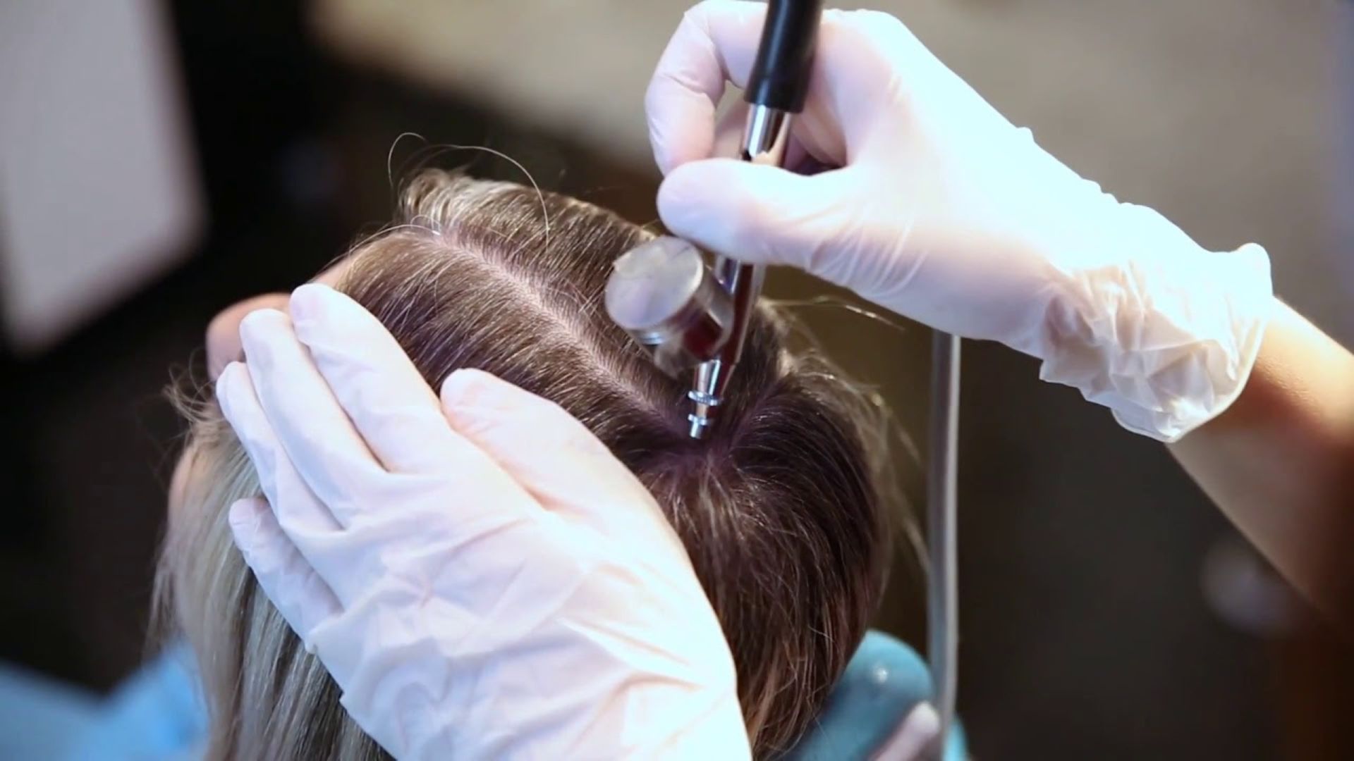 Lice Treatment1